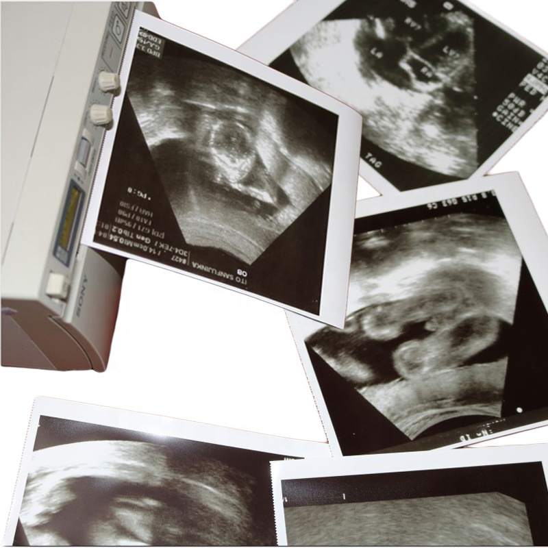 Ultraschall-Thermopapier 110S